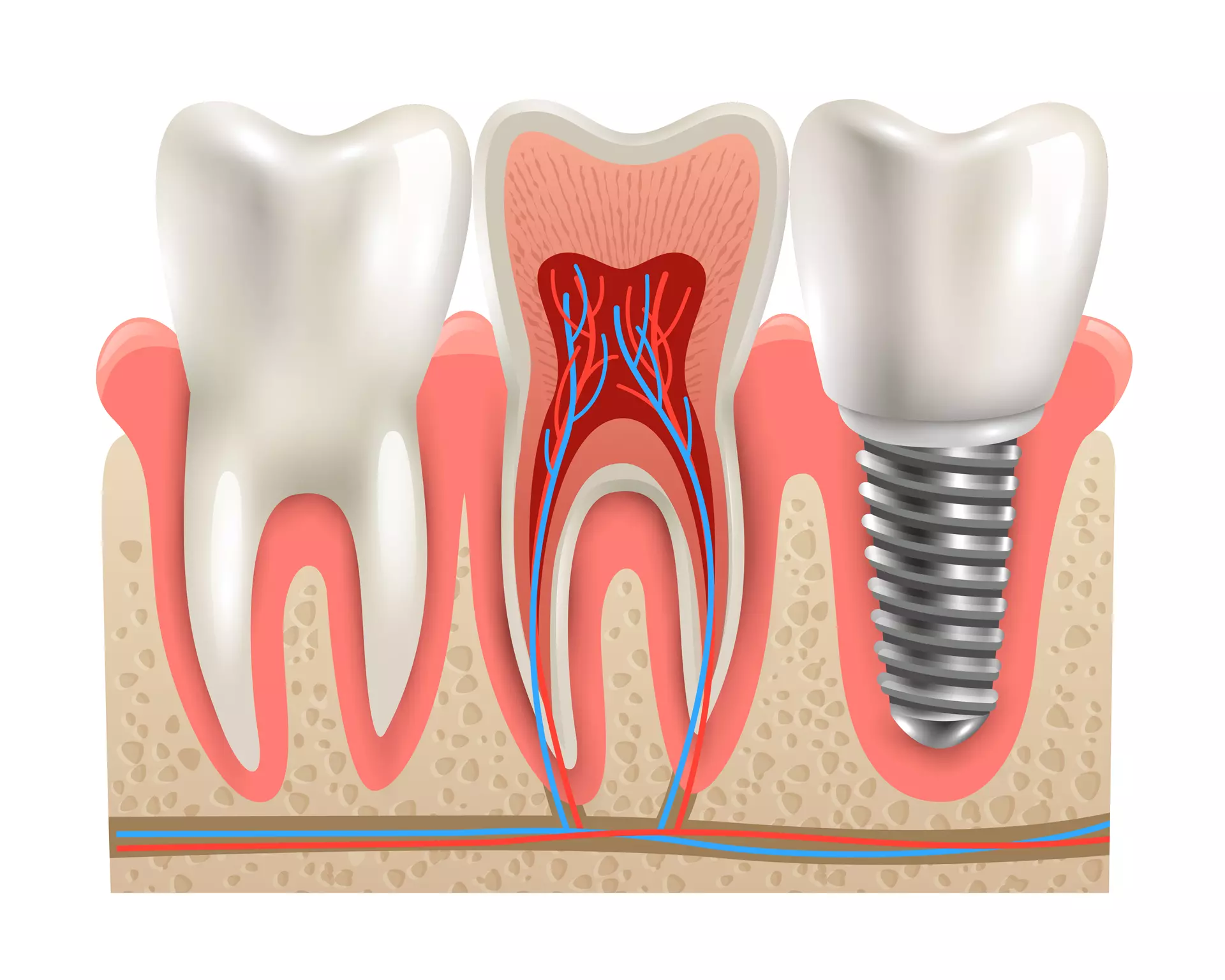Fairfield & Cincinnati Endodontics (Root Canal Therapy)